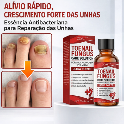 ODALT™ - Diga adeus às unhas com fungos