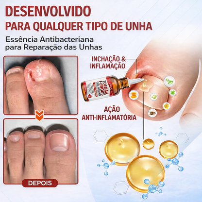 ODALT™ - Diga adeus às unhas com fungos