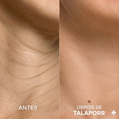 Talaporr - Sistema de microinfusão