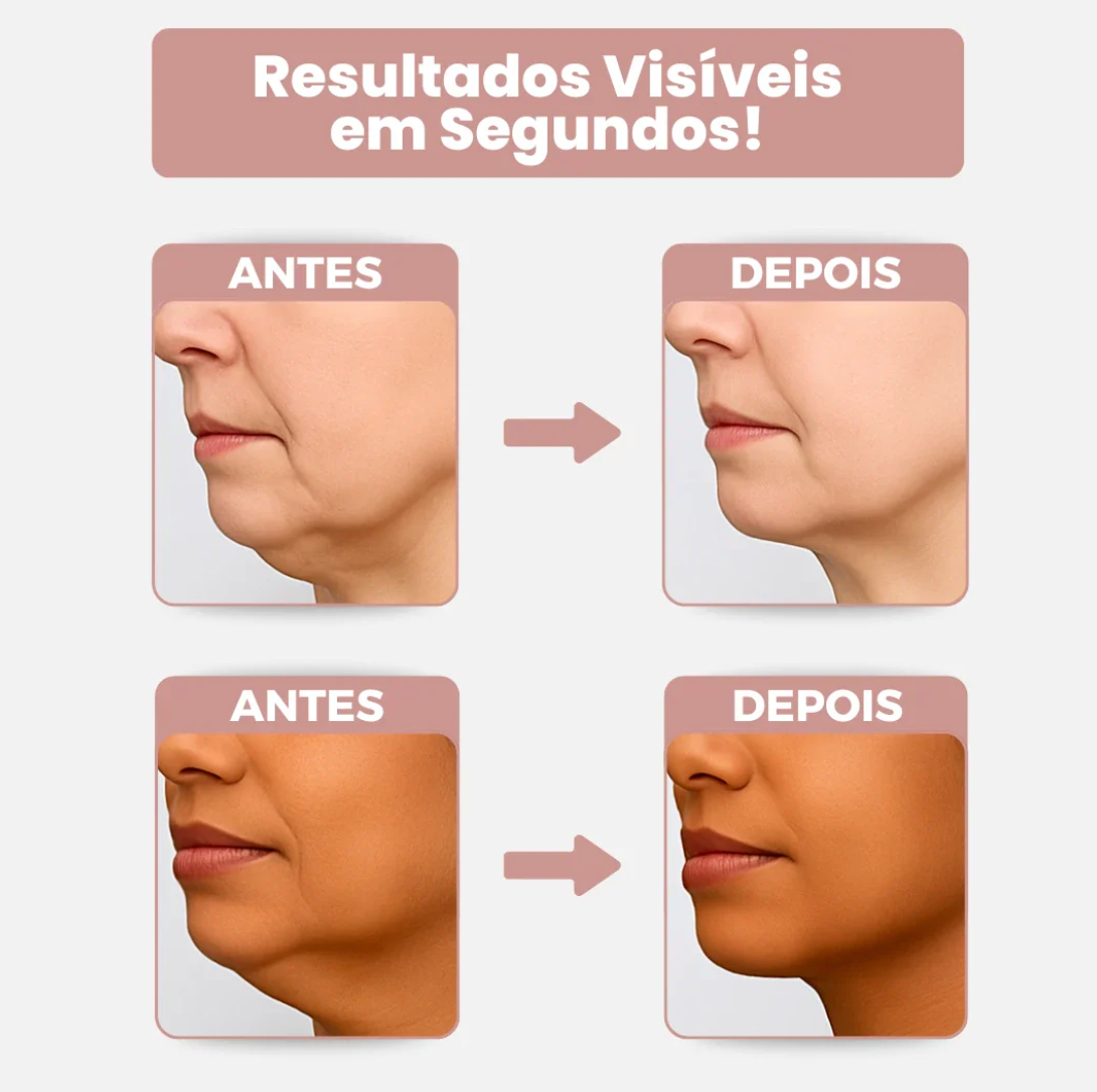 Belle Lift - Adesivo Lifting Antirrugas e Contra Flacidez no Pescoço