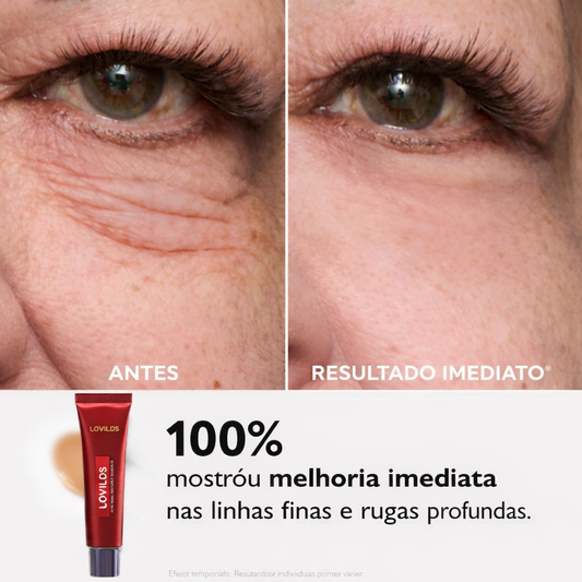 Lovilds - Lift Instantâneo