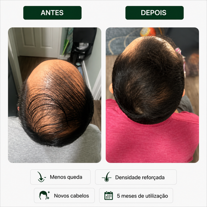Sérum Capilar Bio Densyl