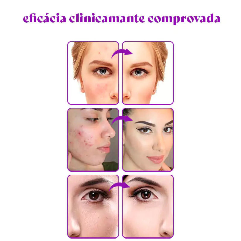 PerfectSync – A Base Inteligente Que Se Adapta à Sua Pele