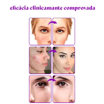 PerfectSync – A Base Inteligente Que Se Adapta à Sua Pele