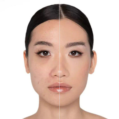 PerfectSync – A Base Inteligente Que Se Adapta à Sua Pele